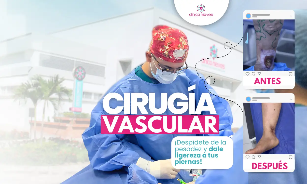 Cirugía vascular
